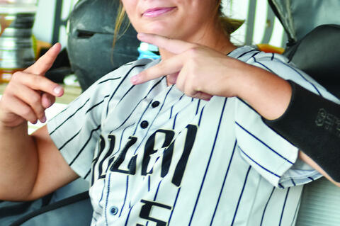 What happens when a bunt play goes wrong? Ayla Manuel found out with this beauty of a black eye.